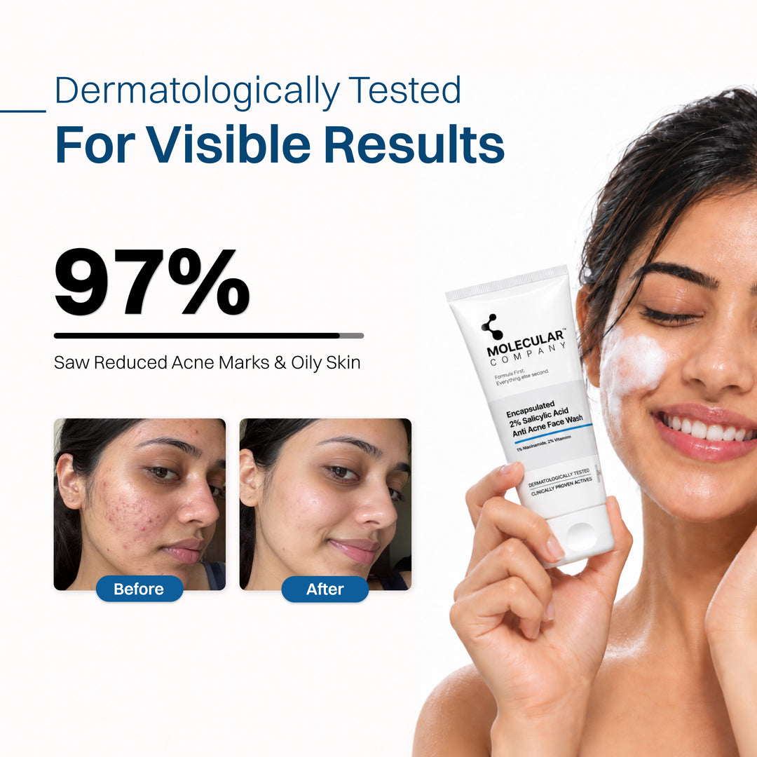 Encapsulated 2% Salicylic Acid Anti Acne Face Wash